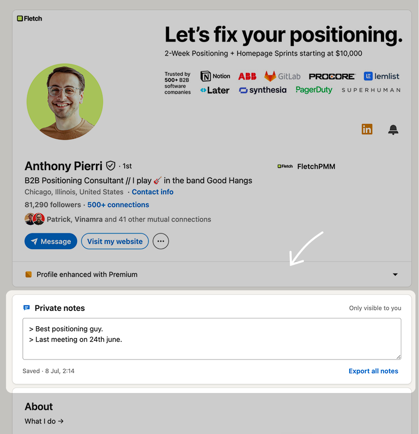 Dogear private notes on Anthony Pierri's LinkedIn profile